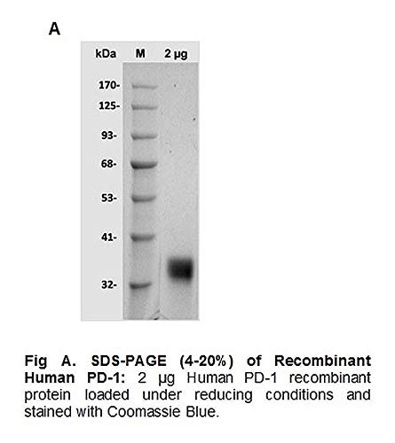 BioVision Human CellExp PD-L1 / CD274 / B7-H1, insan rekombinantı, 7429-1000